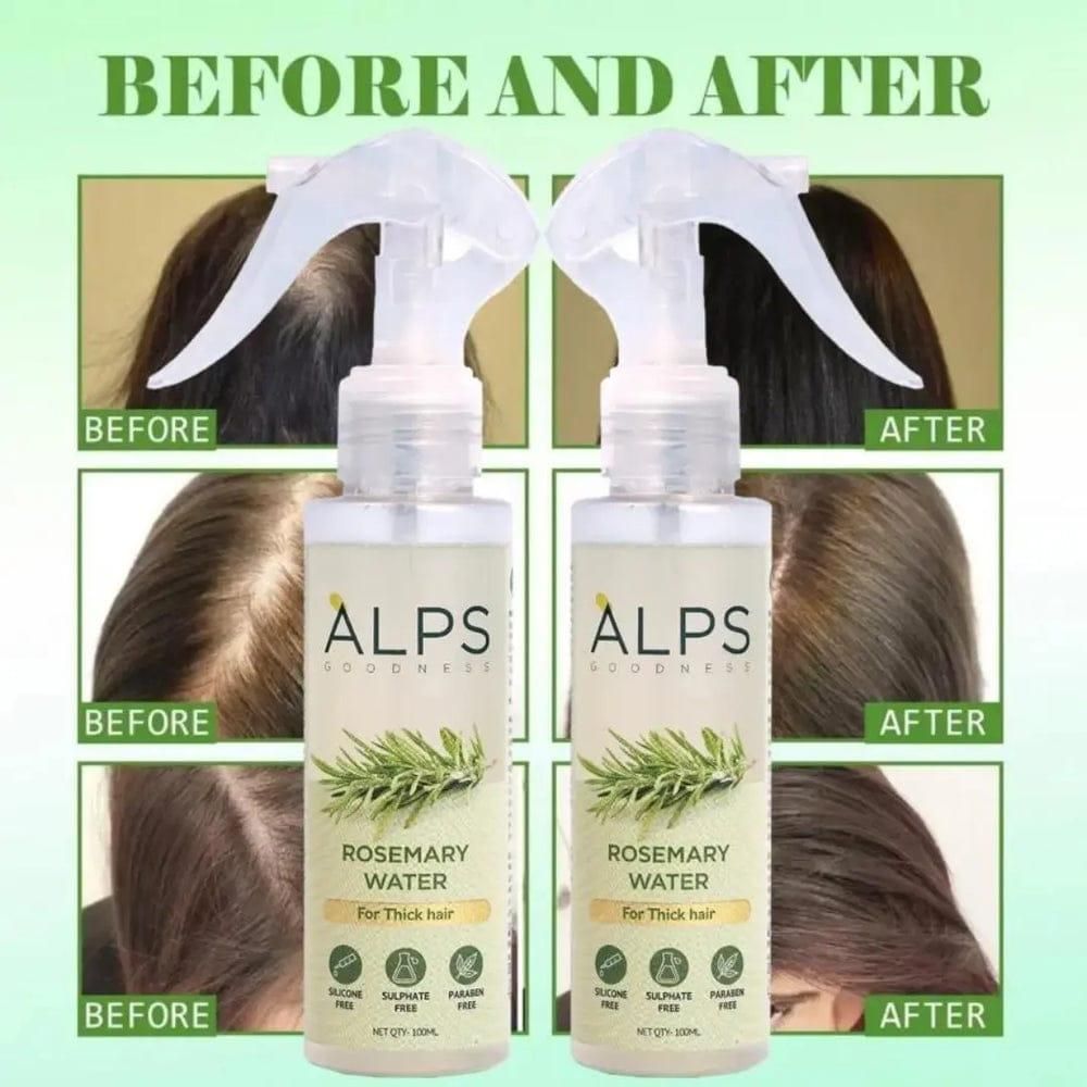 🌿 Rosemary Water Hair Spray – Buy 1 Get 2 FREE | Hair Regrowth & Shine Booster (3 x 100ml)