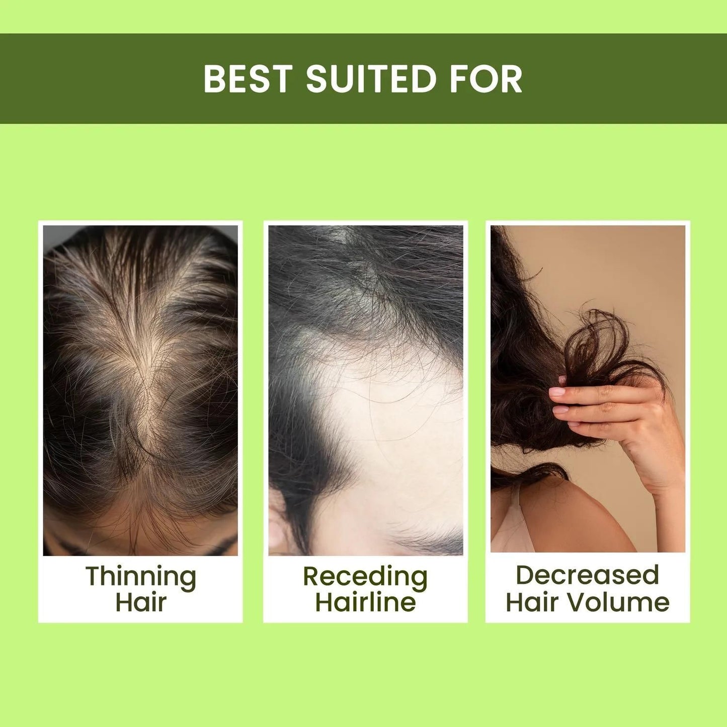 🌿 Rosemary Water Hair Spray – Buy 1 Get 2 FREE | Hair Regrowth & Shine Booster (3 x 100ml)